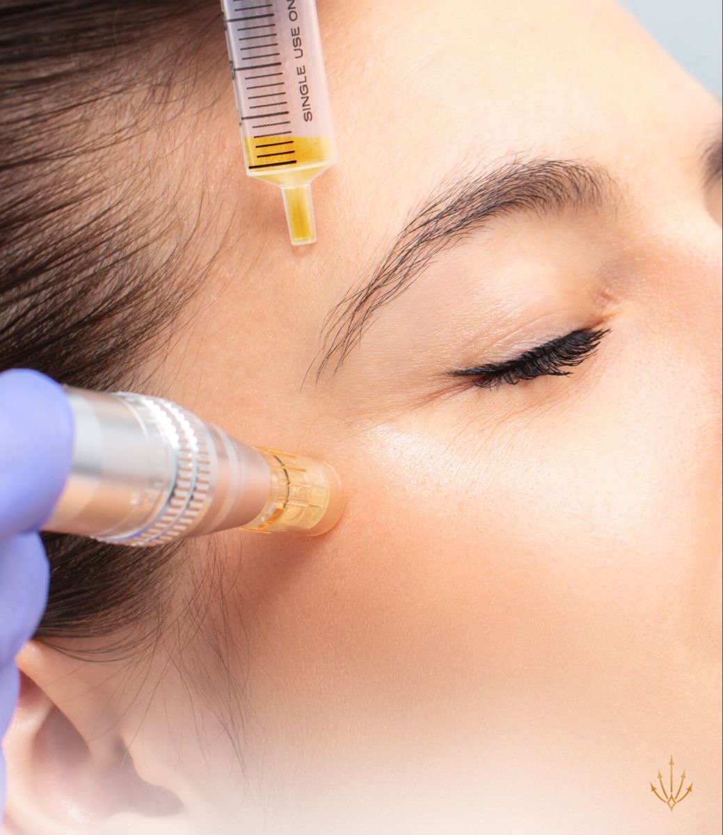 MICRONEEDLING VITAMINA C GLOW