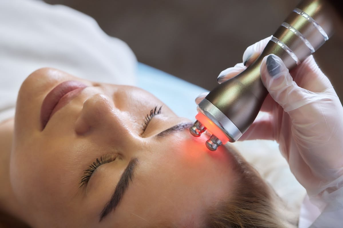 RADIOFRECUENCIA LIFTING FACIAL