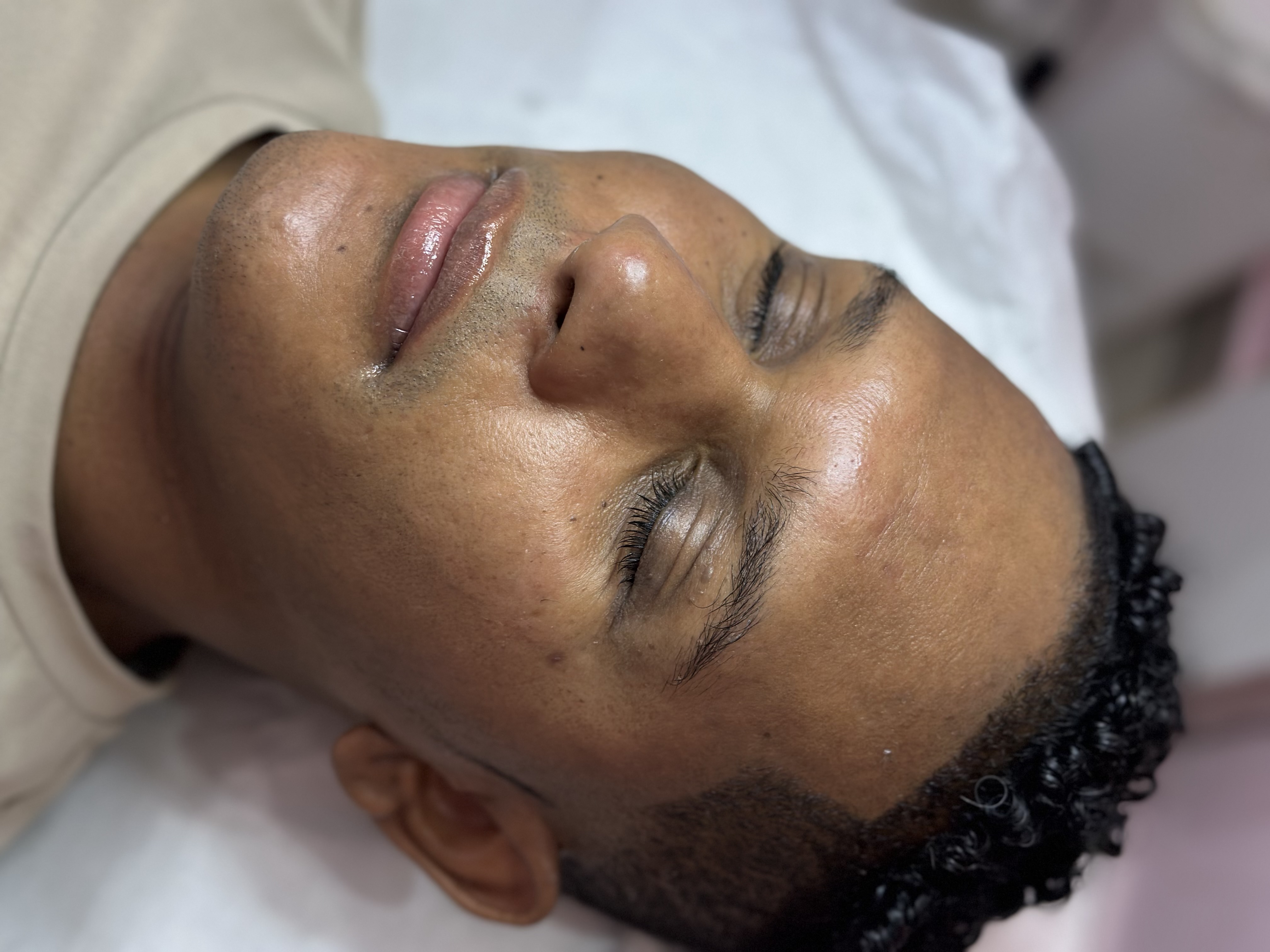 HIDRATACIÓN DE LABIOS