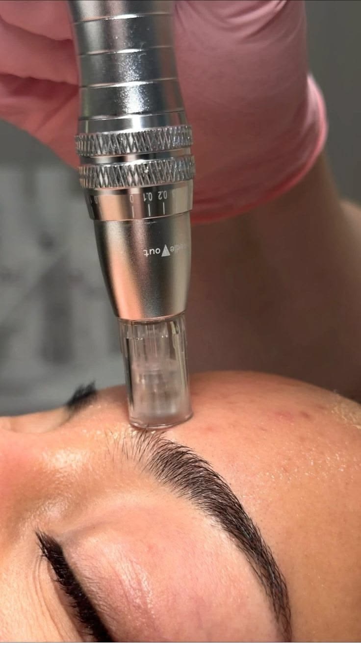 MICRONEEDLING ANTI-AIGING