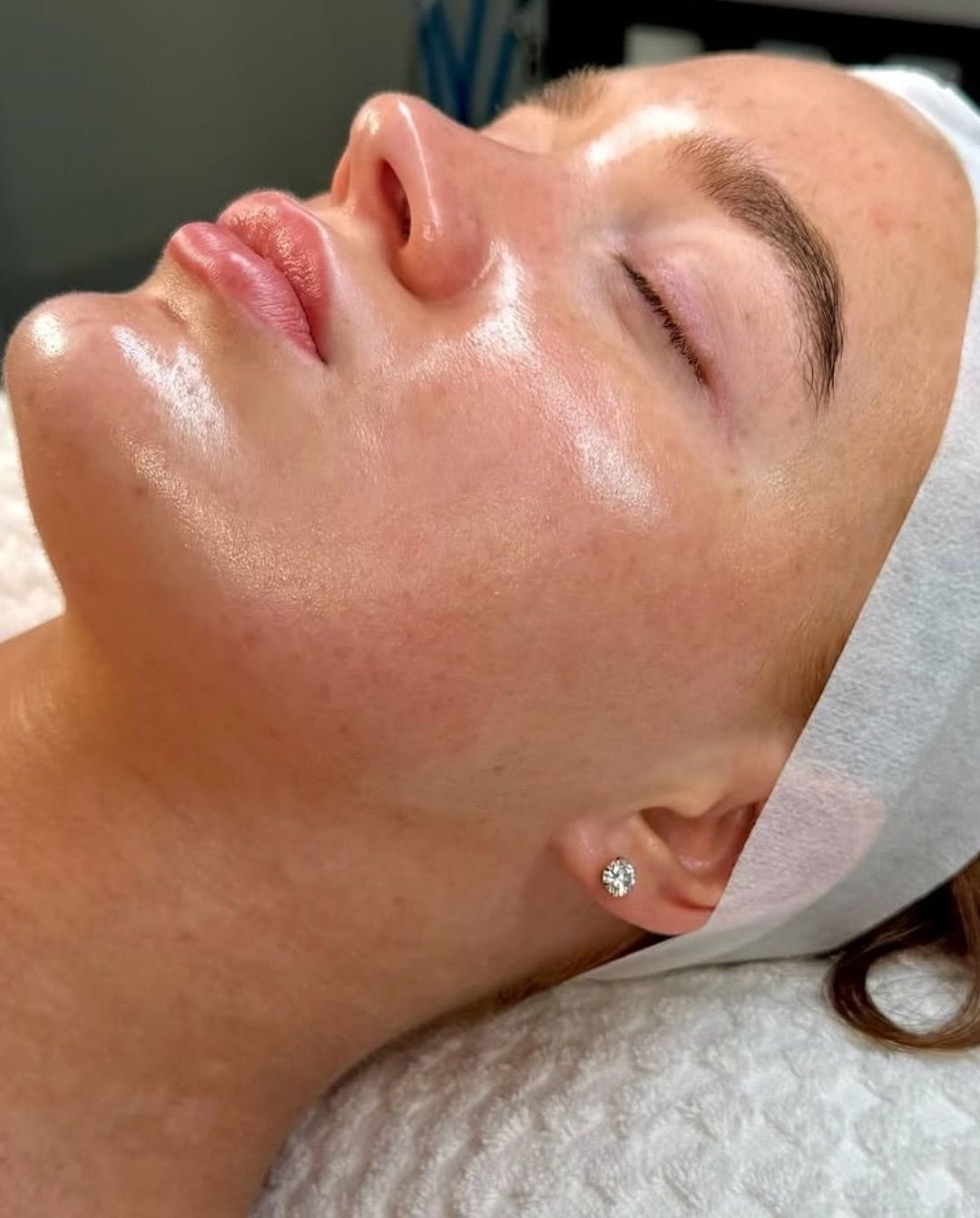 ✨ GLOW BALANCE | LIMPIEZA FACIAL + PEELING  MANDELICO